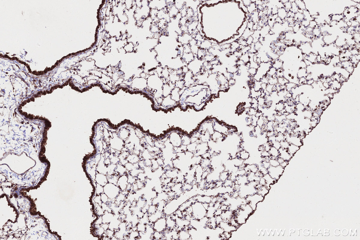 Immunohistochemical analysis of paraffin-embedded mouse lung tissue slide using KHC2659 (DIS3L2 IHC Kit).