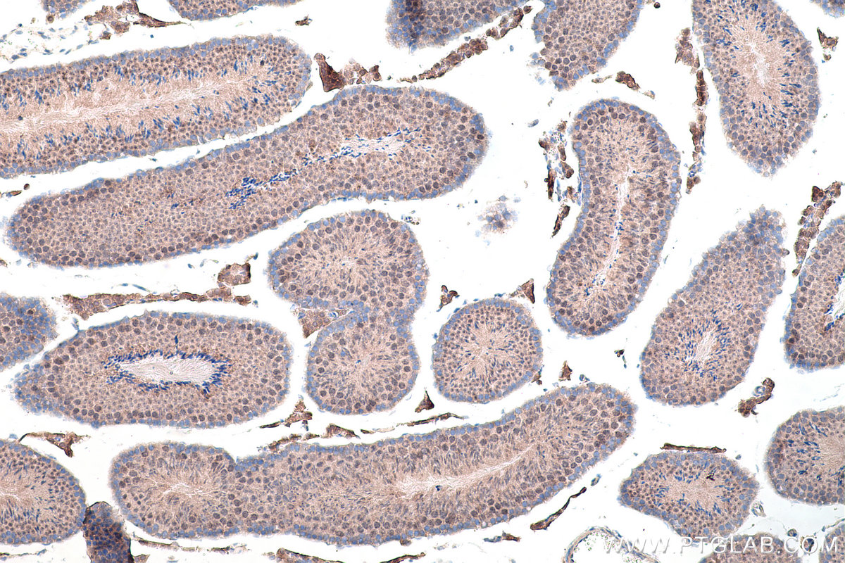 Immunohistochemical analysis of paraffin-embedded mouse testis tissue slide using KHC0186 (DKC1 IHC Kit).