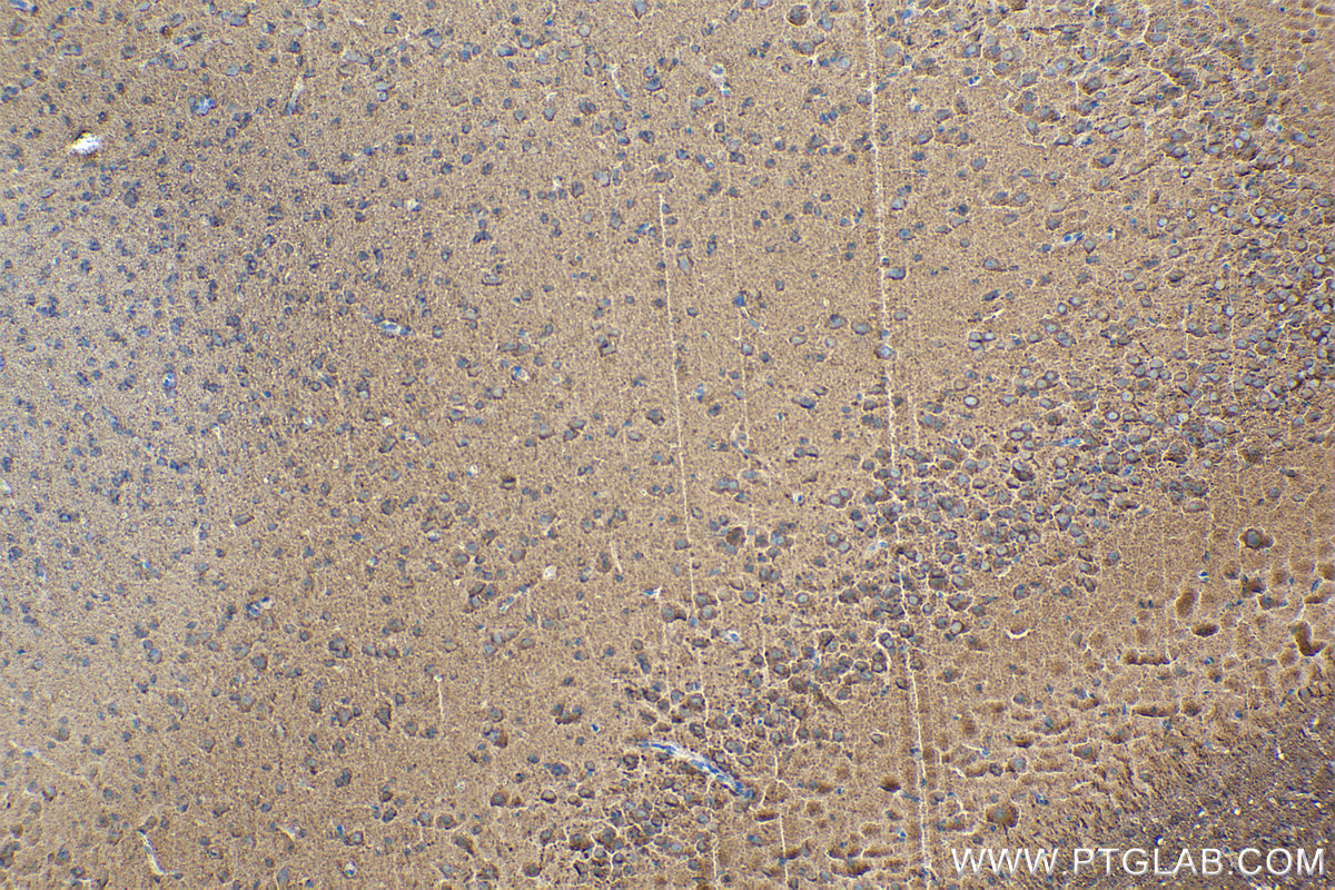 Immunohistochemical analysis of paraffin-embedded rat brain tissue slide using KHC0119 (DKK3 IHC Kit).