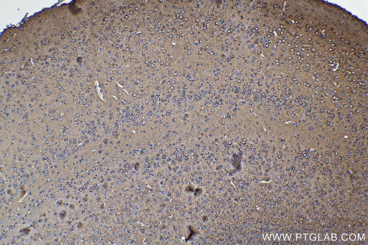 Immunohistochemical analysis of paraffin-embedded mouse brain tissue slide using KHC0119 (DKK3 IHC Kit).