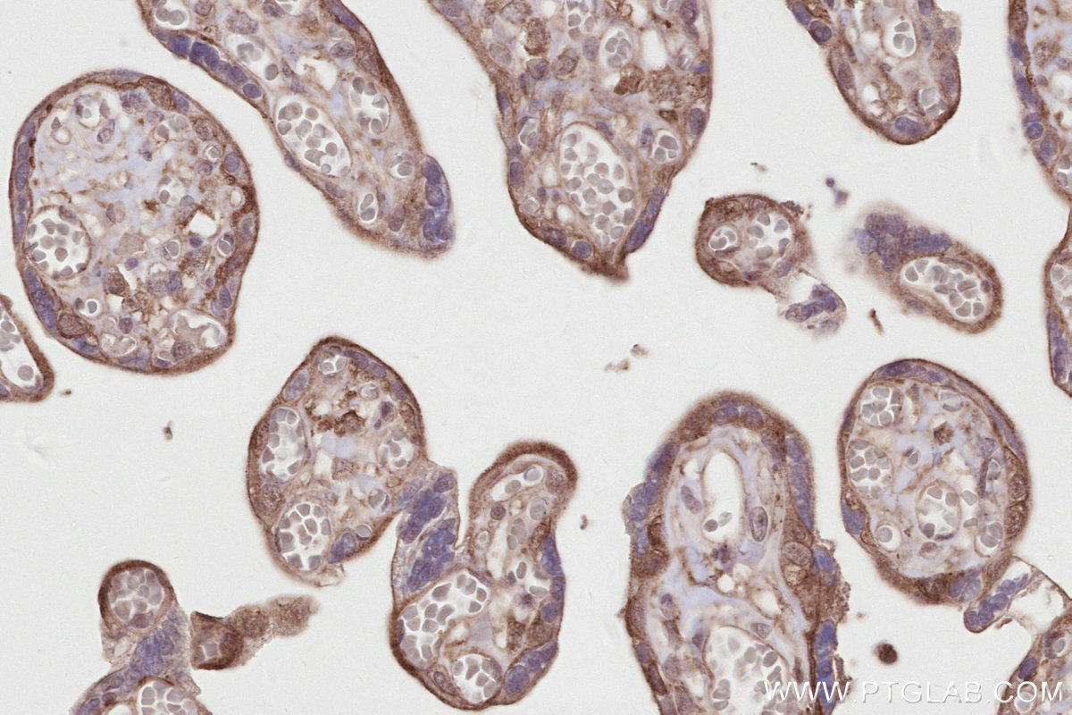 Immunohistochemical analysis of paraffin-embedded human placenta tissue slide using KHC2821 (DLC1 IHC Kit).