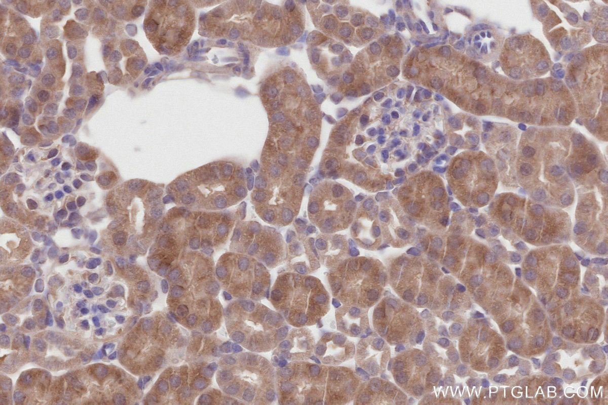 Immunohistochemical analysis of paraffin-embedded mouse kidney tissue slide using KHC2821 (DLC1 IHC Kit).