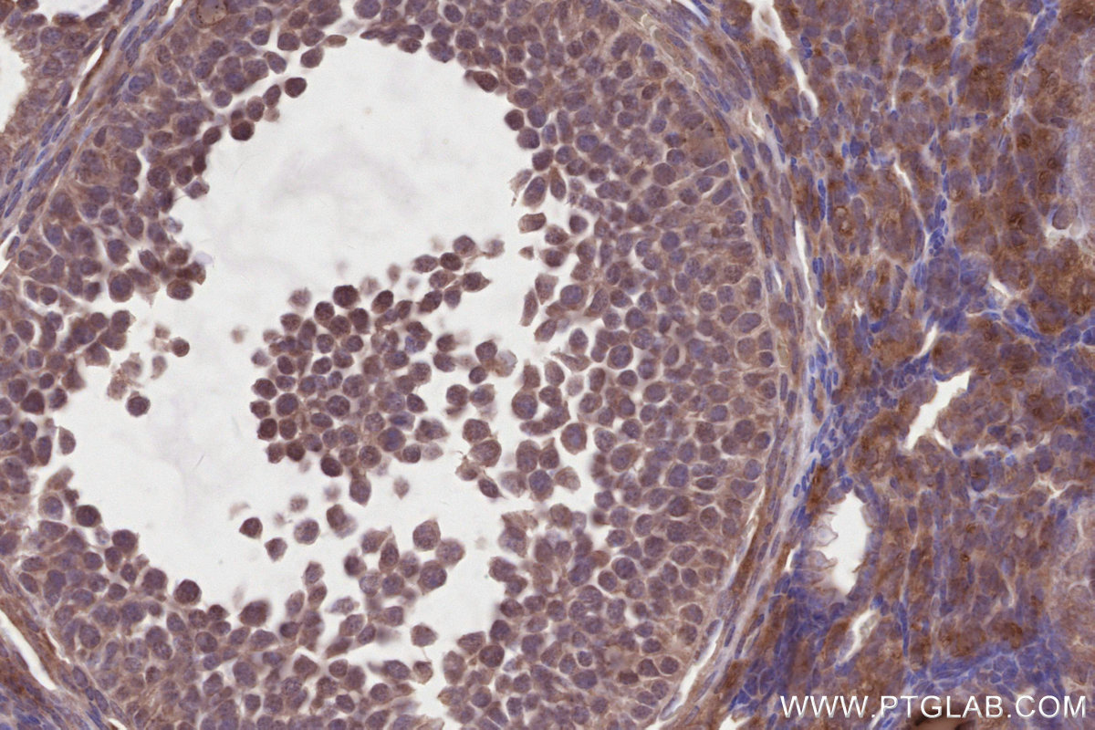 Immunohistochemical analysis of paraffin-embedded mouse ovary tissue slide using KHC2821 (DLC1 IHC Kit).