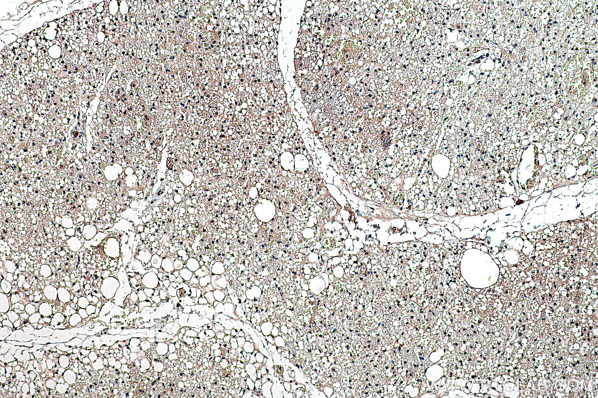 Immunohistochemical analysis of paraffin-embedded rat brown adipose tissue slide using KHC0306 (DLK1 IHC Kit).