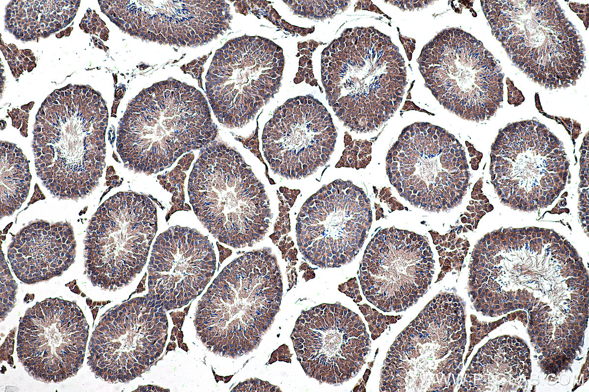 Immunohistochemical analysis of paraffin-embedded mouse testis tissue slide using KHC0306 (DLK1 IHC Kit).