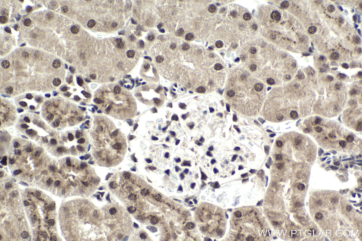 Immunohistochemical analysis of paraffin-embedded rat kidney tissue slide using KHC1953 (DMAP1 IHC Kit).