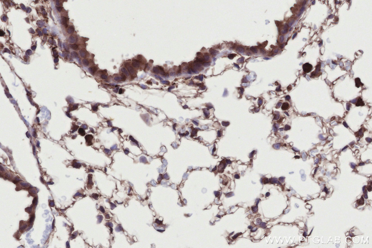 Immunohistochemical analysis of paraffin-embedded mouse lung tissue slide using KHC2718 (DMXL2 IHC Kit).