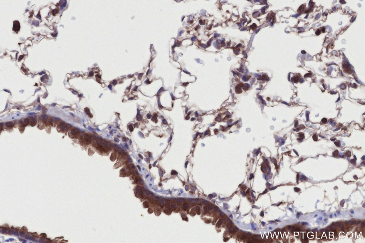 Immunohistochemical analysis of paraffin-embedded rat lung tissue slide using KHC2718 (DMXL2 IHC Kit).