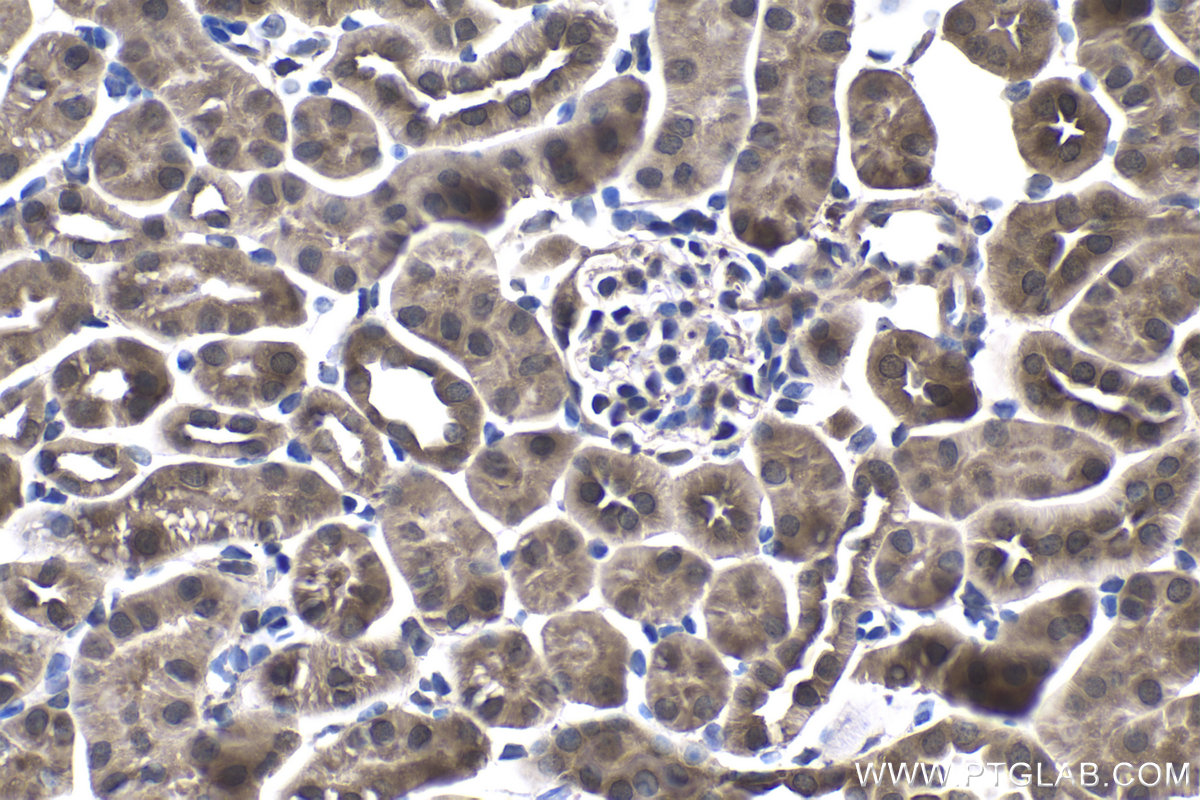 Immunohistochemical analysis of paraffin-embedded mouse kidney tissue slide using KHC1040 (DNAJA2 IHC Kit).