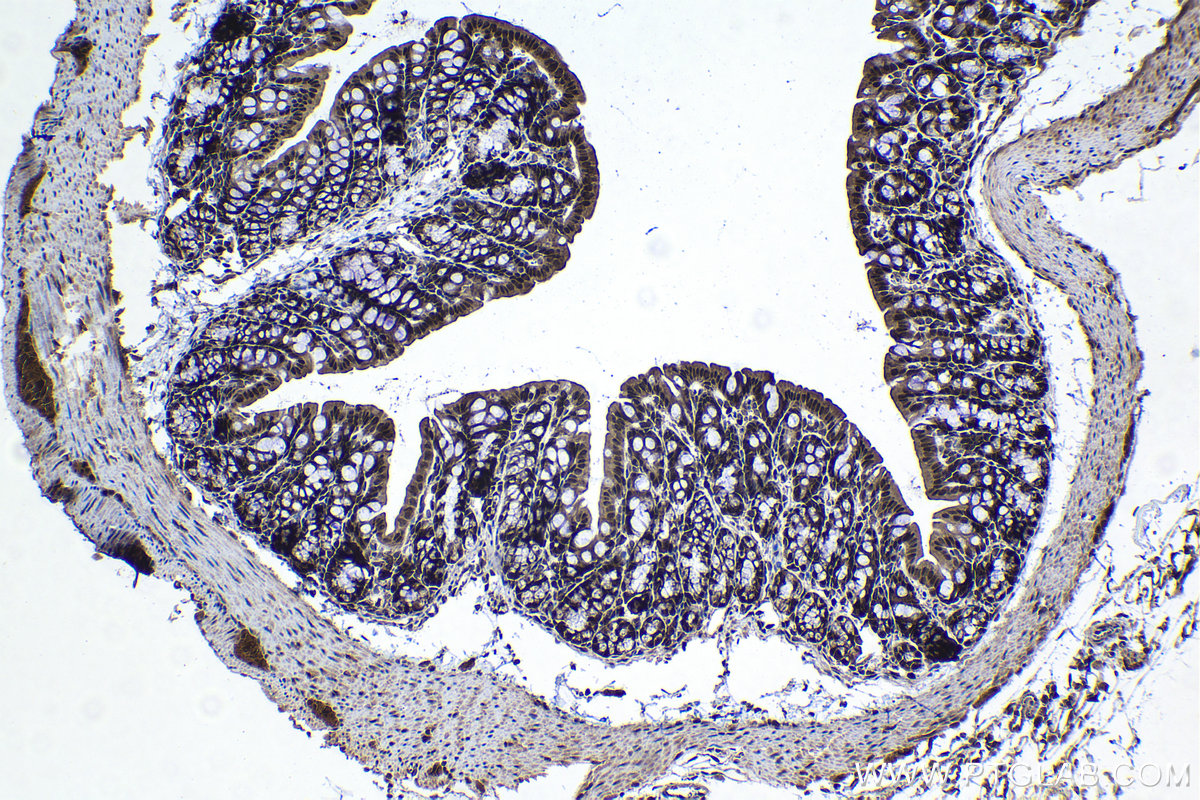 Immunohistochemical analysis of paraffin-embedded mouse colon tissue slide using KHC1128 (DNAJB1 IHC Kit).