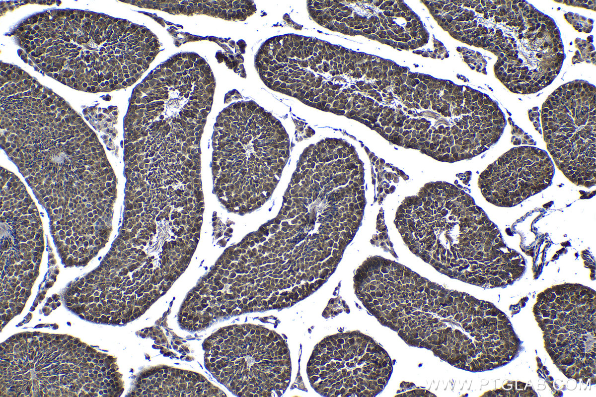 Immunohistochemical analysis of paraffin-embedded mouse testis tissue slide using KHC1128 (DNAJB1 IHC Kit).