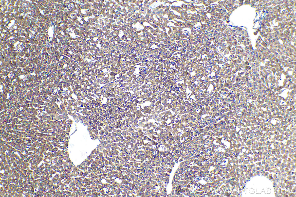 Immunohistochemical analysis of paraffin-embedded mouse liver tissue slide using KHC0936 (DNAJB11 IHC Kit).