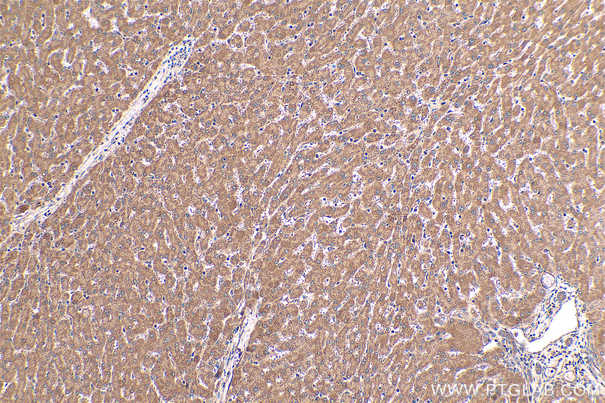 Immunohistochemical analysis of paraffin-embedded human liver tissue slide using KHC0414 (DNAJC12 IHC Kit).