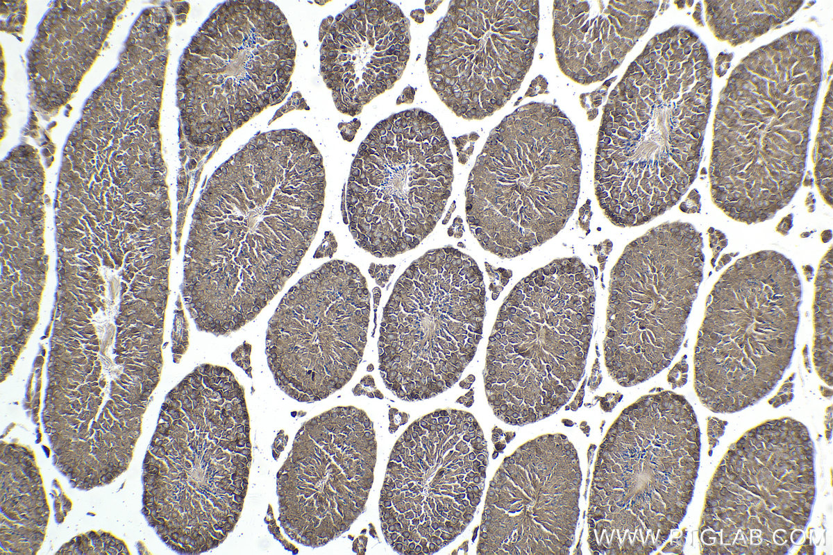 Immunohistochemical analysis of paraffin-embedded mouse testis tissue slide using KHC1890 (DNAJC2/ZRF1 IHC Kit).