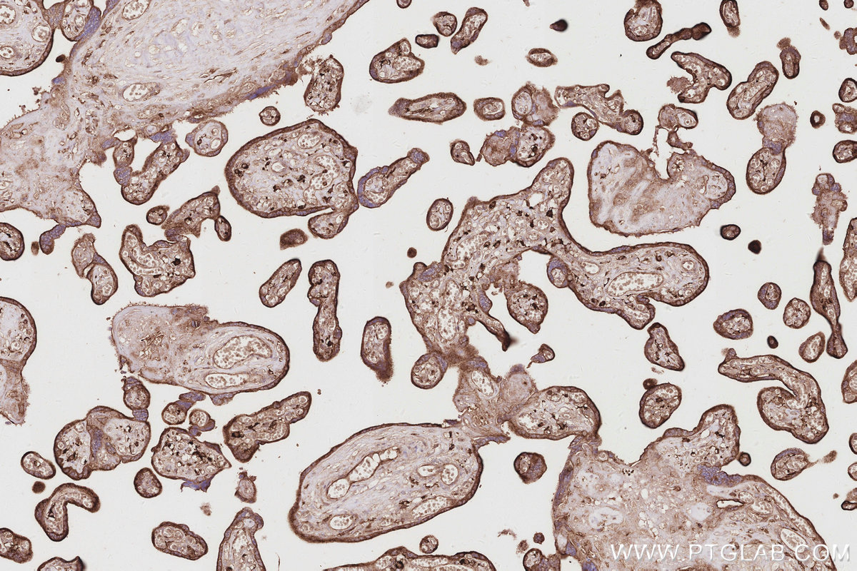 Immunohistochemical analysis of paraffin-embedded human placenta tissue slide using KHC2914 (DNAJC5 IHC Kit).