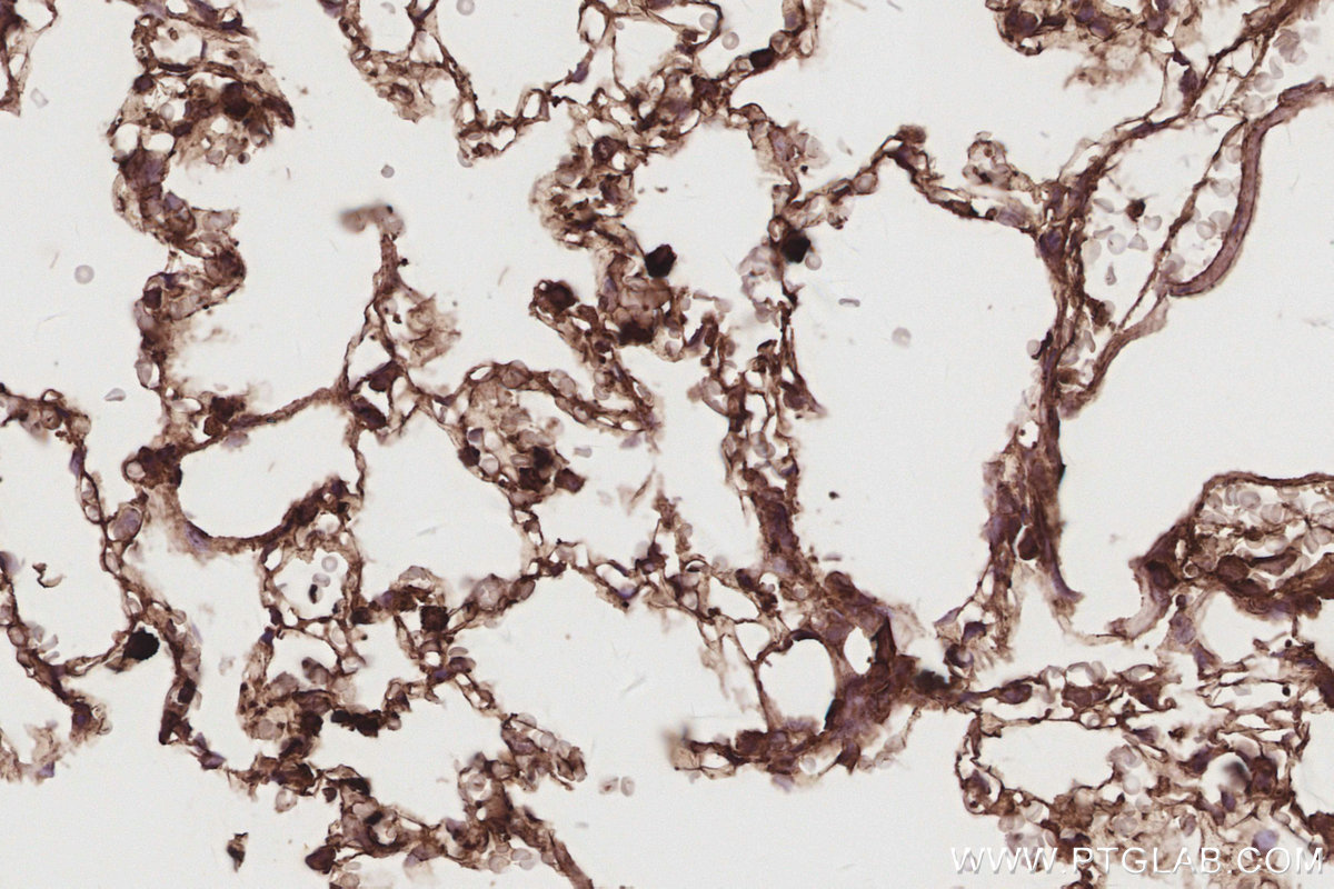 Immunohistochemical analysis of paraffin-embedded rat lung tissue slide using KHC2914 (DNAJC5 IHC Kit).