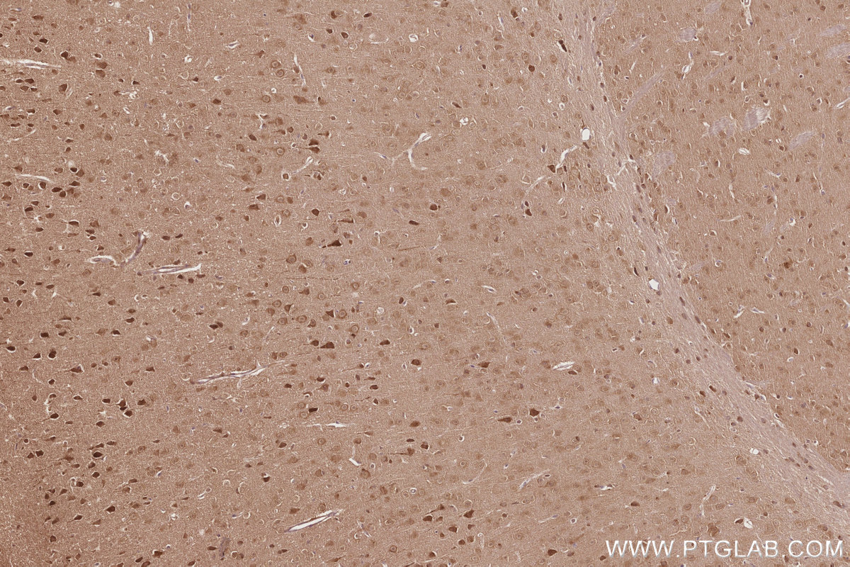 Immunohistochemical analysis of paraffin-embedded mouse brain tissue slide using KHC2844 (DNAJC7 IHC Kit).