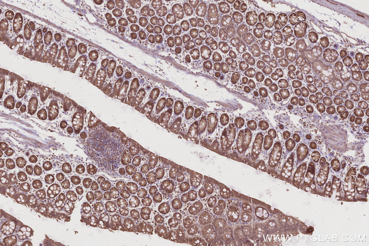 Immunohistochemical analysis of paraffin-embedded mouse colon tissue slide using KHC2844 (DNAJC7 IHC Kit).