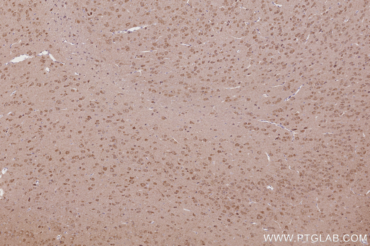 Immunohistochemical analysis of paraffin-embedded rat brain tissue slide using KHC2844 (DNAJC7 IHC Kit).