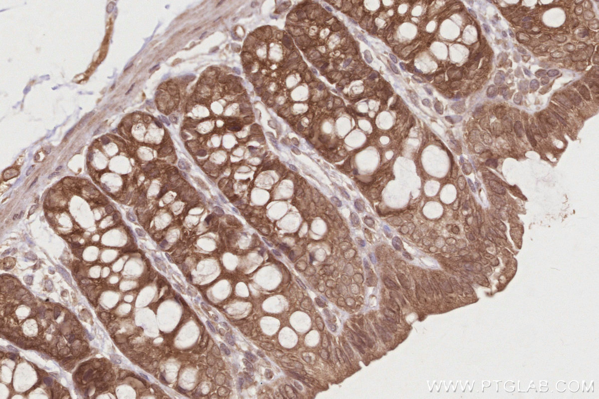 Immunohistochemical analysis of paraffin-embedded rat colon tissue slide using KHC2844 (DNAJC7 IHC Kit).
