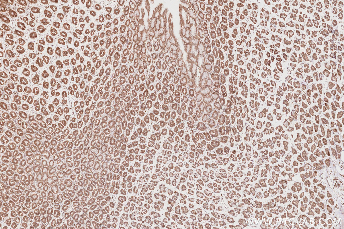 Immunohistochemical analysis of paraffin-embedded rat stomach tissue slide using KHC2844 (DNAJC7 IHC Kit).