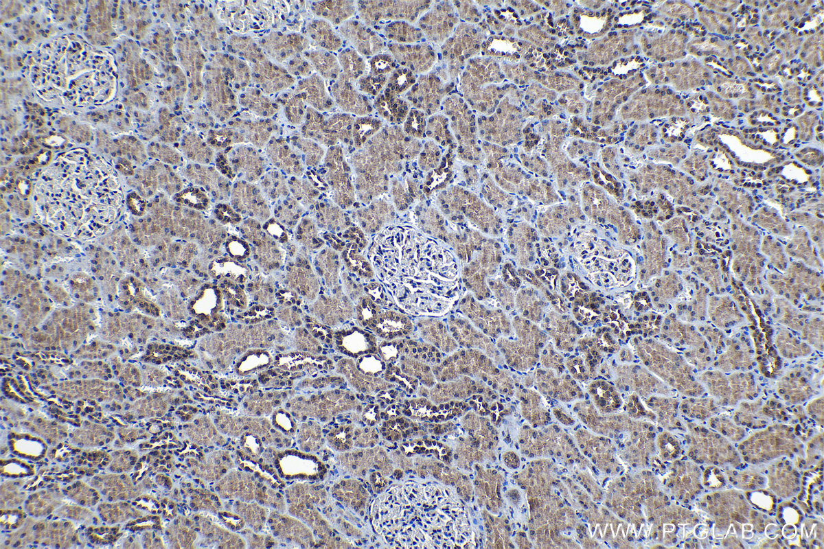 Immunohistochemical analysis of paraffin-embedded human kidney tissue slide using KHC1129 (DNAJC9 IHC Kit).