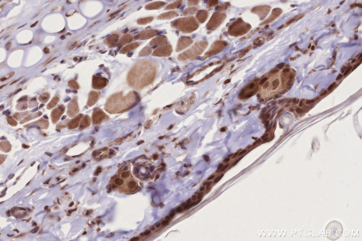 Immunohistochemical analysis of paraffin-embedded rat skin tissue slide using KHC2780 (DOCK10 IHC Kit).
