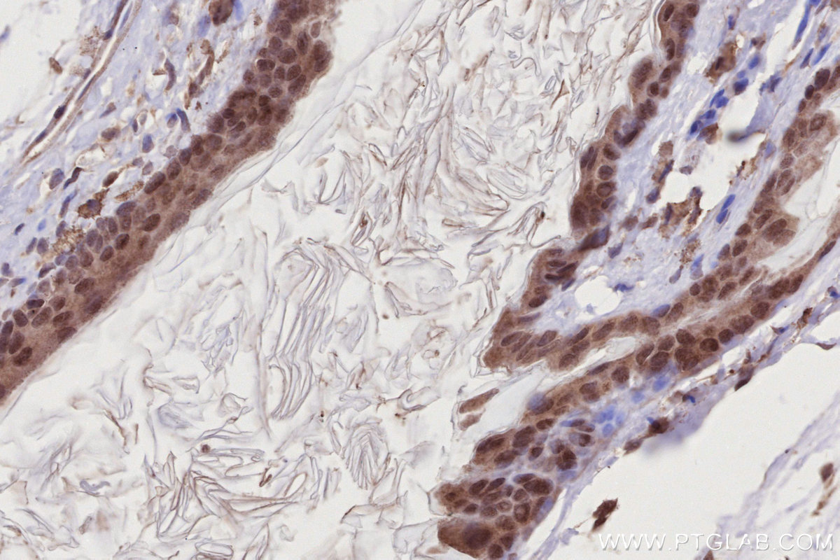Immunohistochemical analysis of paraffin-embedded mouse skin tissue slide using KHC2780 (DOCK10 IHC Kit).