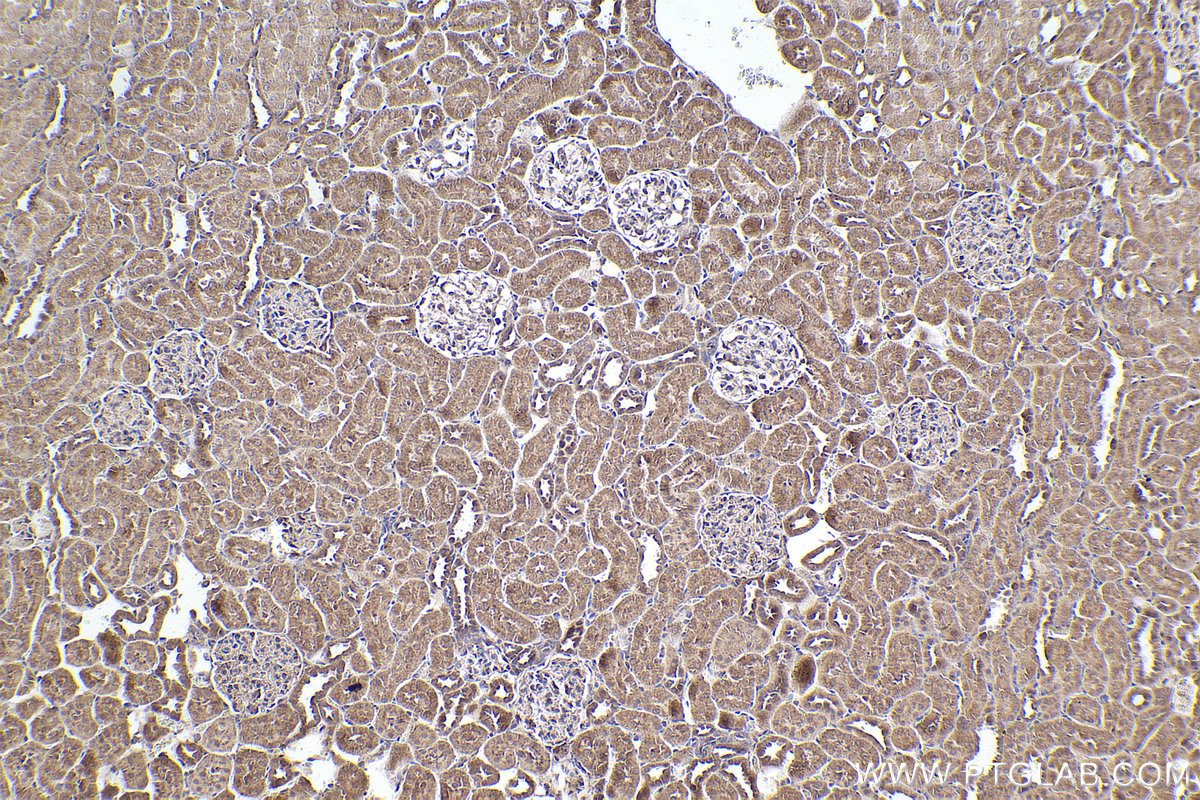 Immunohistochemical analysis of paraffin-embedded rat kidney tissue slide using KHC2544 (DOCK11 IHC Kit).