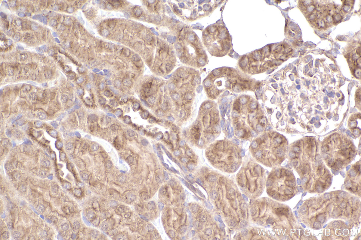 Immunohistochemical analysis of paraffin-embedded mouse kidney tissue slide using KHC2544 (DOCK11 IHC Kit).