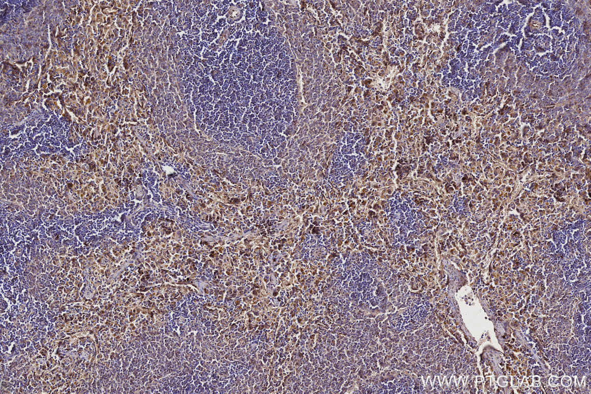Immunohistochemical analysis of paraffin-embedded rat spleen tissue slide using KHC2747 (DOCK2 IHC Kit).