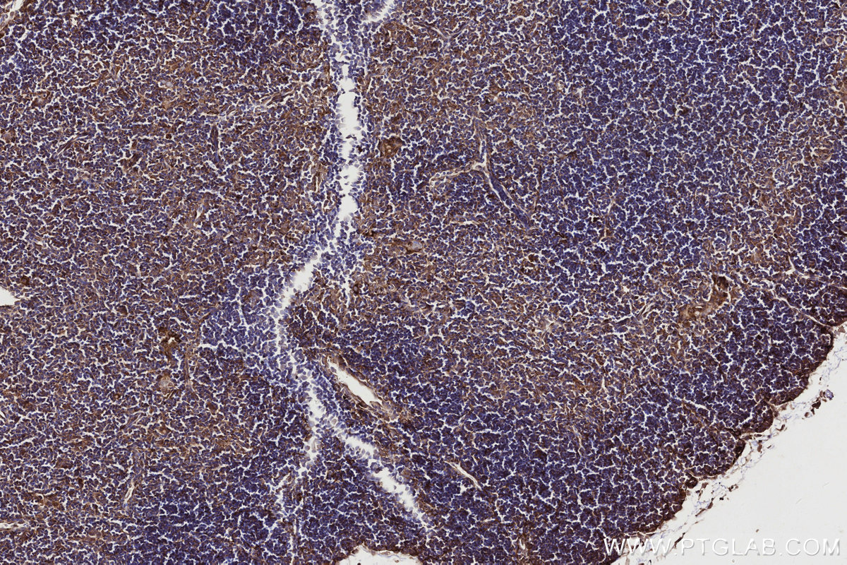 Immunohistochemical analysis of paraffin-embedded mouse thymus tissue slide using KHC2747 (DOCK2 IHC Kit).