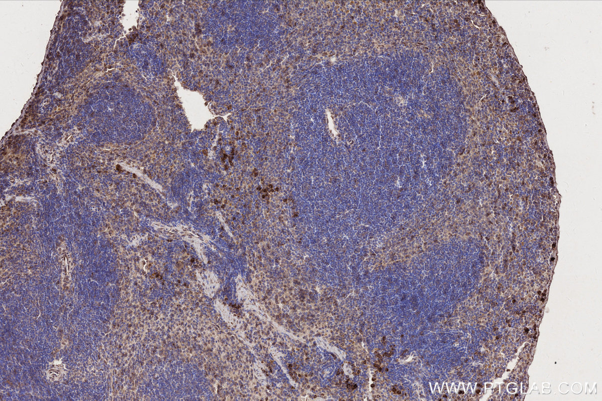 Immunohistochemical analysis of paraffin-embedded mouse spleen tissue slide using KHC2747 (DOCK2 IHC Kit).