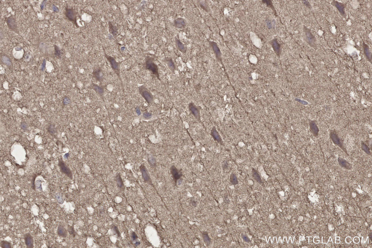 Immunohistochemical analysis of paraffin-embedded mouse brain tissue slide using KHC2663 (DOCK3 IHC Kit).