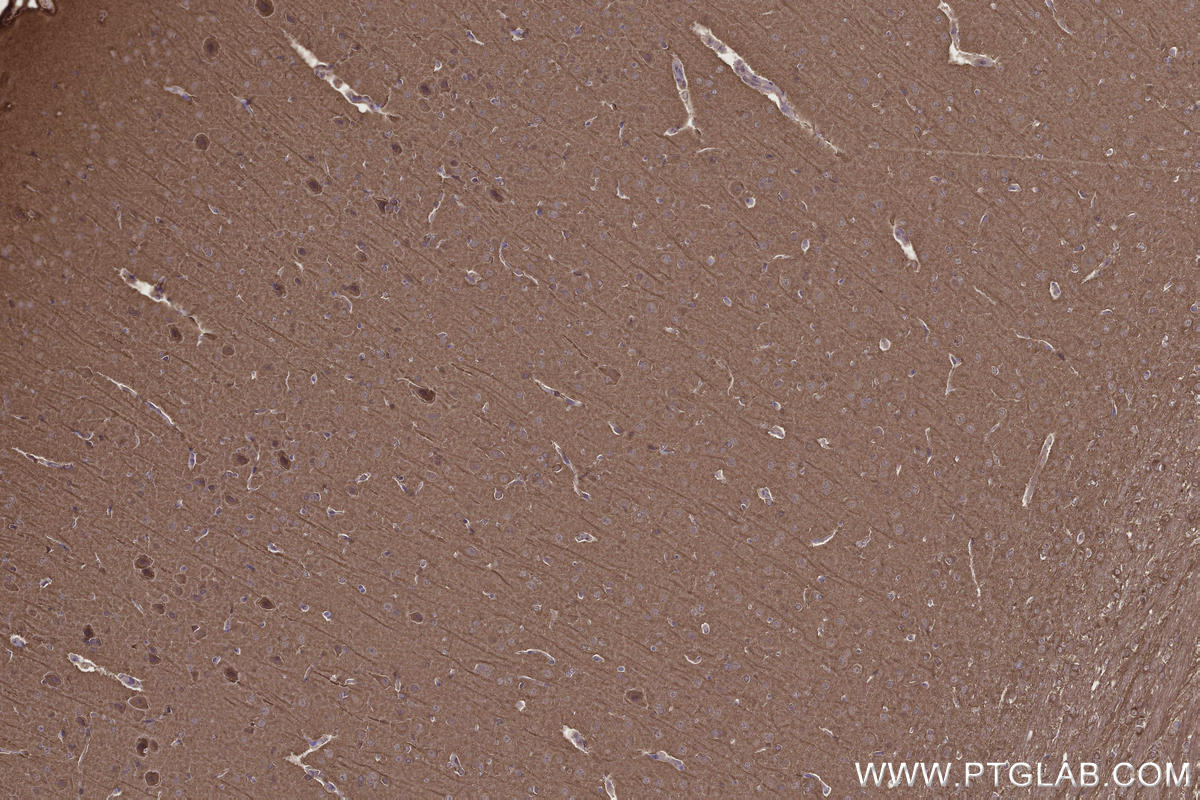 Immunohistochemical analysis of paraffin-embedded rat brain tissue slide using KHC2663 (DOCK3 IHC Kit).
