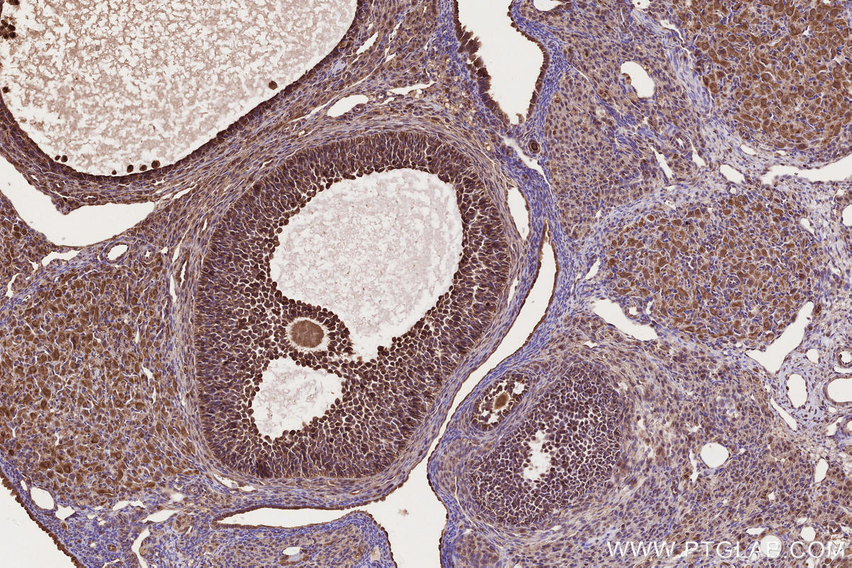 Immunohistochemical analysis of paraffin-embedded rat ovary tissue slide using KHC2668 (DOCK4 IHC Kit).