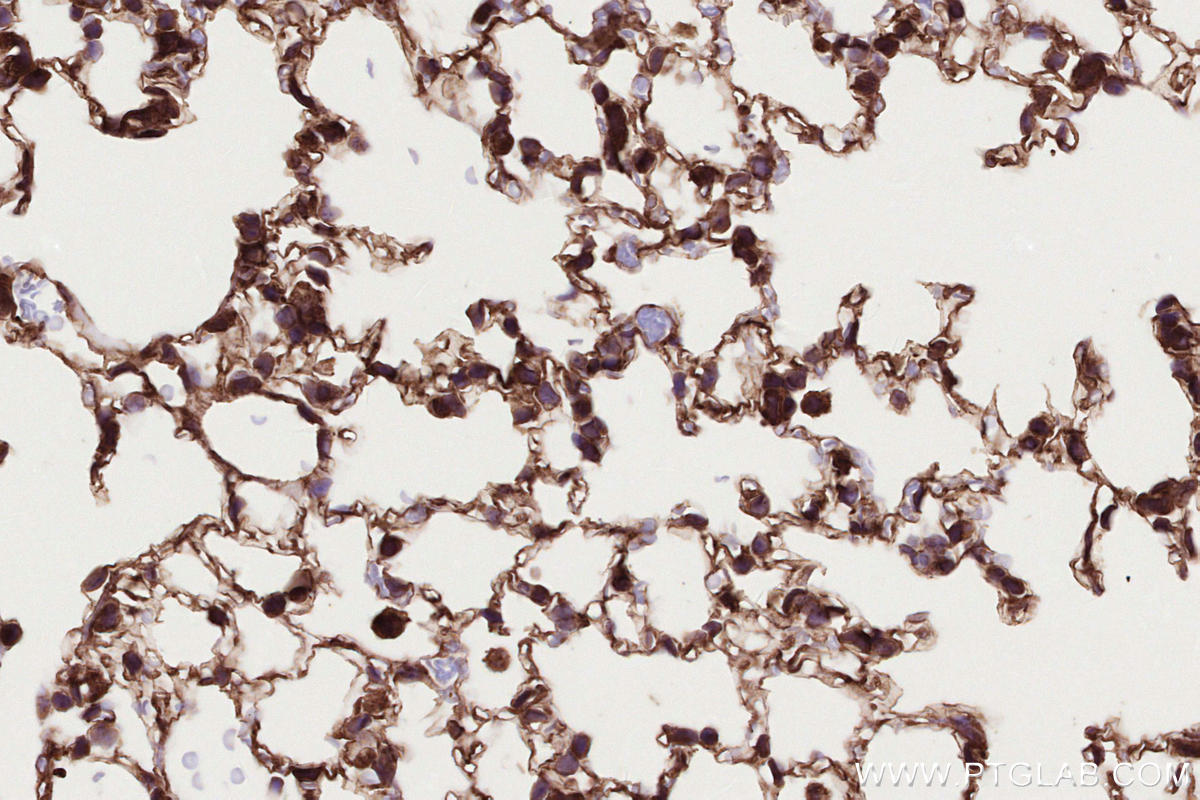 Immunohistochemical analysis of paraffin-embedded mouse lung tissue slide using KHC2668 (DOCK4 IHC Kit).
