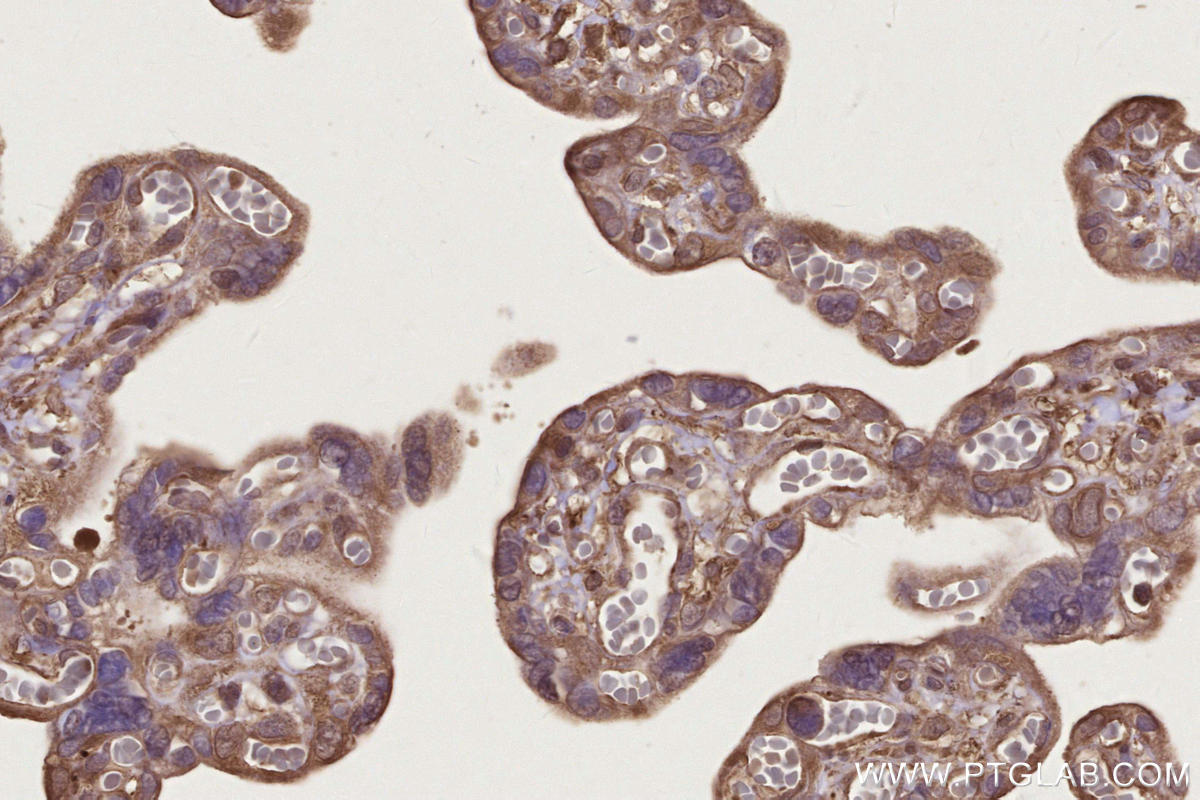 Immunohistochemical analysis of paraffin-embedded human placenta tissue slide using KHC2668 (DOCK4 IHC Kit).