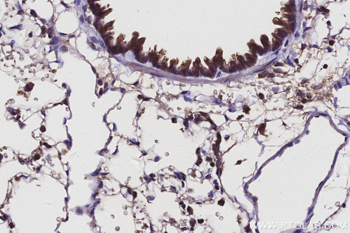 Immunohistochemical analysis of paraffin-embedded rat lung tissue slide using KHC2924 (DOCK5 IHC Kit).