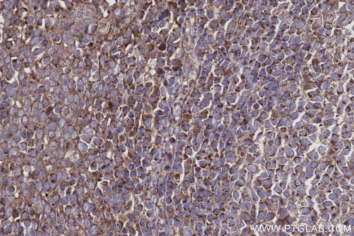 Immunohistochemical analysis of paraffin-embedded human tonsillitis tissue slide using KHC2924 (DOCK5 IHC Kit).