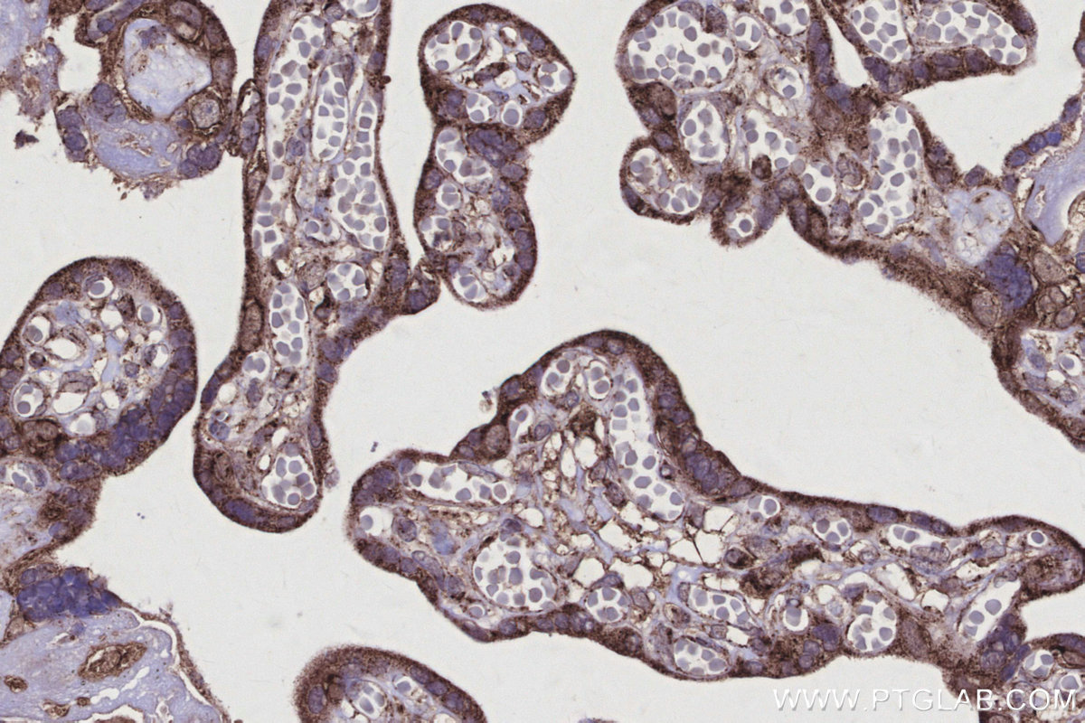 Immunohistochemical analysis of paraffin-embedded human placenta tissue slide using KHC2924 (DOCK5 IHC Kit).