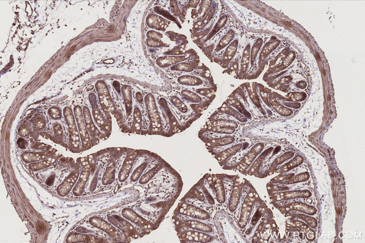 Immunohistochemical analysis of paraffin-embedded mouse colon tissue slide using KHC2797 (DOCK6 IHC Kit).