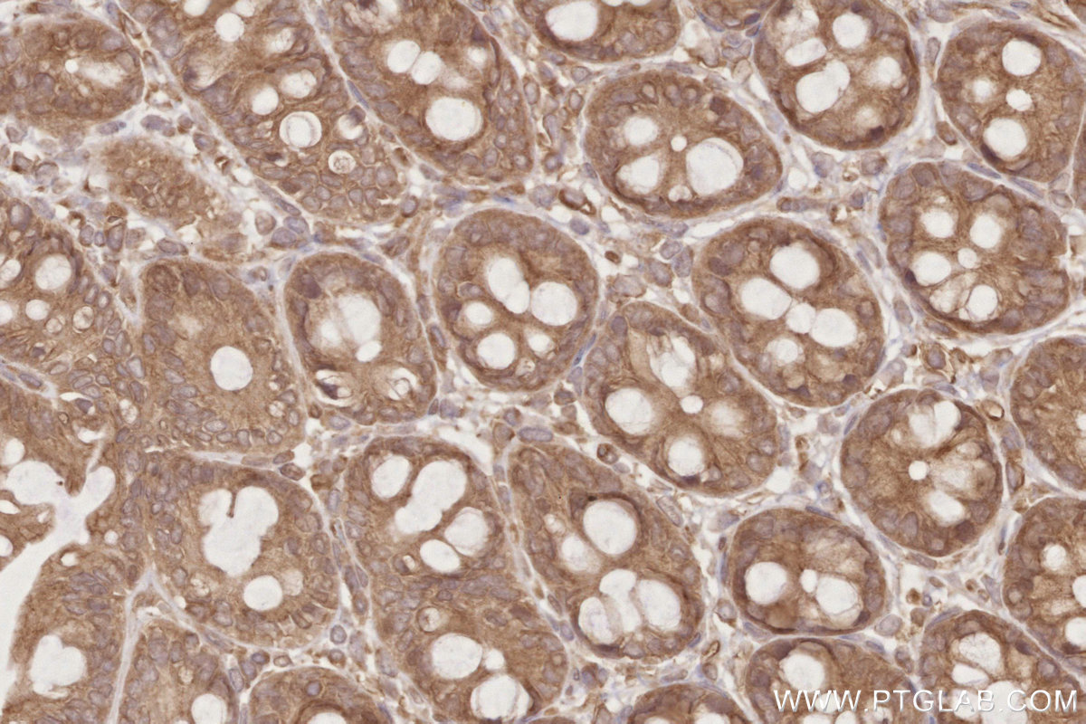 Immunohistochemical analysis of paraffin-embedded rat colon tissue slide using KHC2797 (DOCK6 IHC Kit).