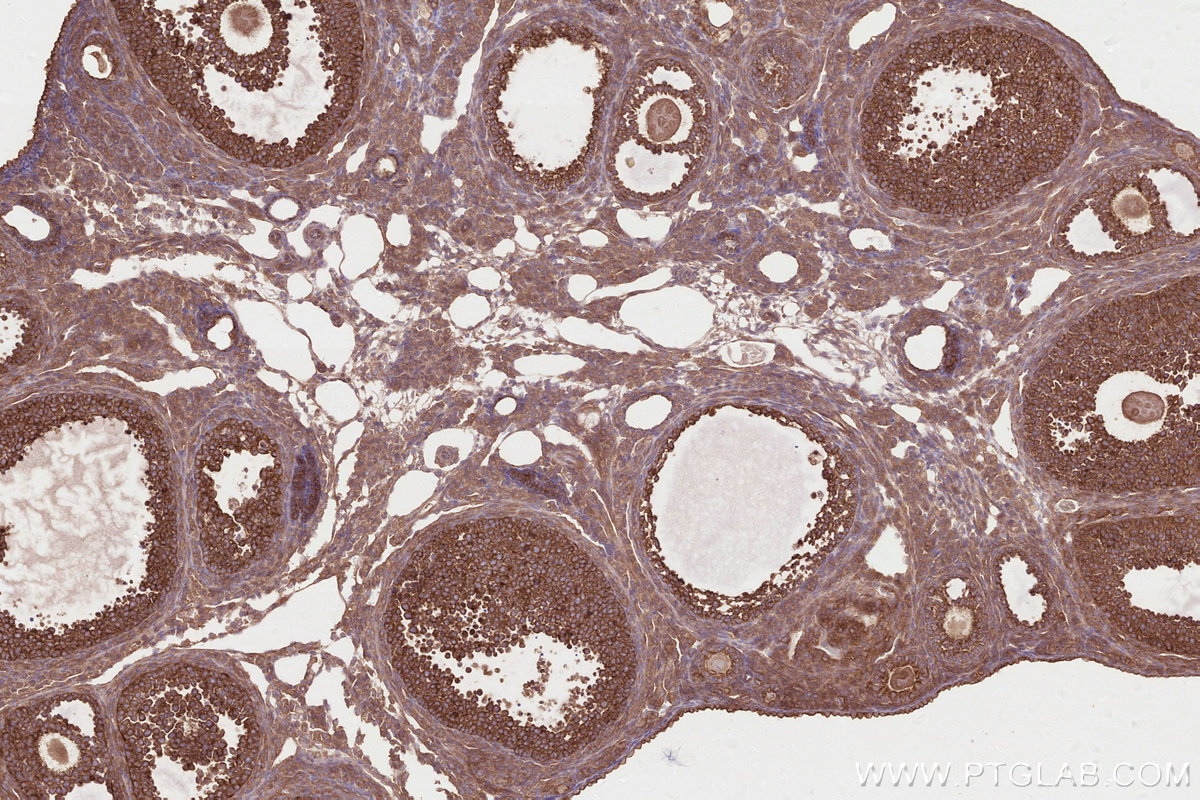 Immunohistochemical analysis of paraffin-embedded mouse ovary tissue slide using KHC2809 (DOCK7 IHC Kit).