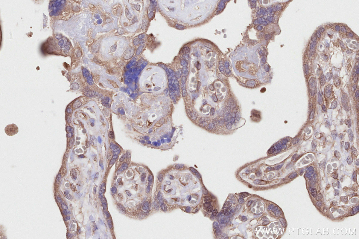 Immunohistochemical analysis of paraffin-embedded human placenta tissue slide using KHC2809 (DOCK7 IHC Kit).