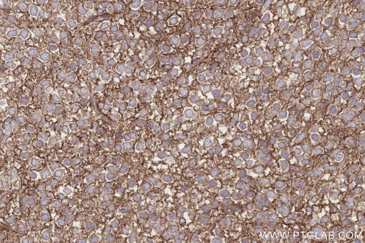 Immunohistochemical analysis of paraffin-embedded mouse embryo tissue slide using KHC2809 (DOCK7 IHC Kit).