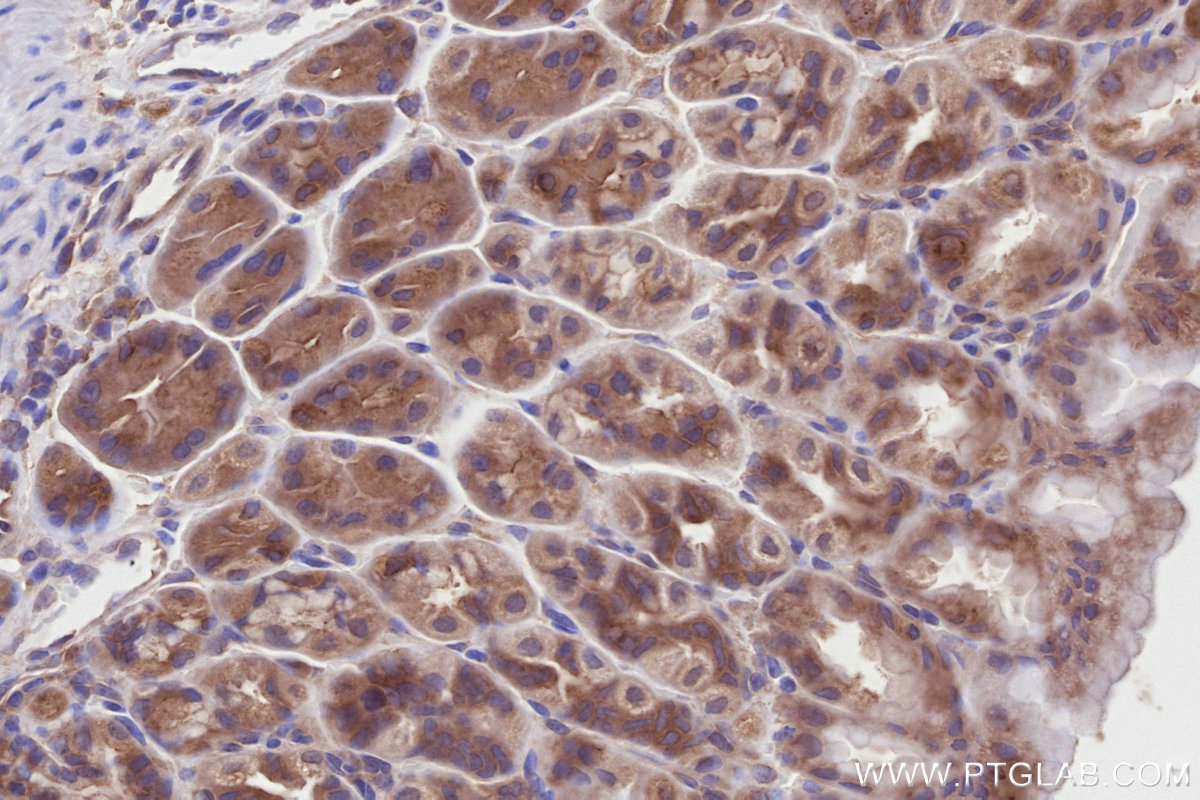 Immunohistochemical analysis of paraffin-embedded mouse stomach tissue slide using KHC2809 (DOCK7 IHC Kit).