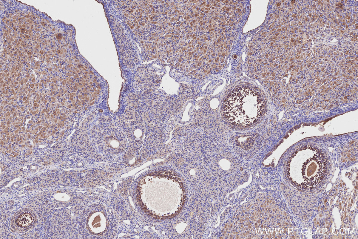 Immunohistochemical analysis of paraffin-embedded rat ovary tissue slide using KHC2809 (DOCK7 IHC Kit).