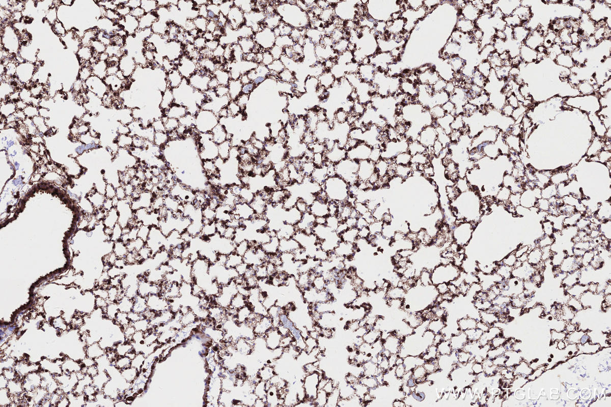 Immunohistochemical analysis of paraffin-embedded mouse lung tissue slide using KHC2694 (DOCK8 IHC Kit).