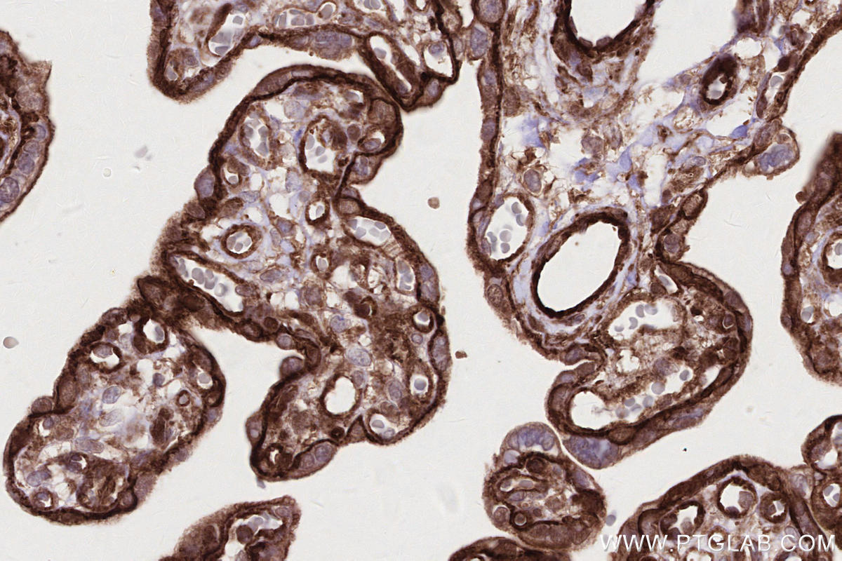 Immunohistochemical analysis of paraffin-embedded human placenta tissue slide using KHC2694 (DOCK8 IHC Kit).